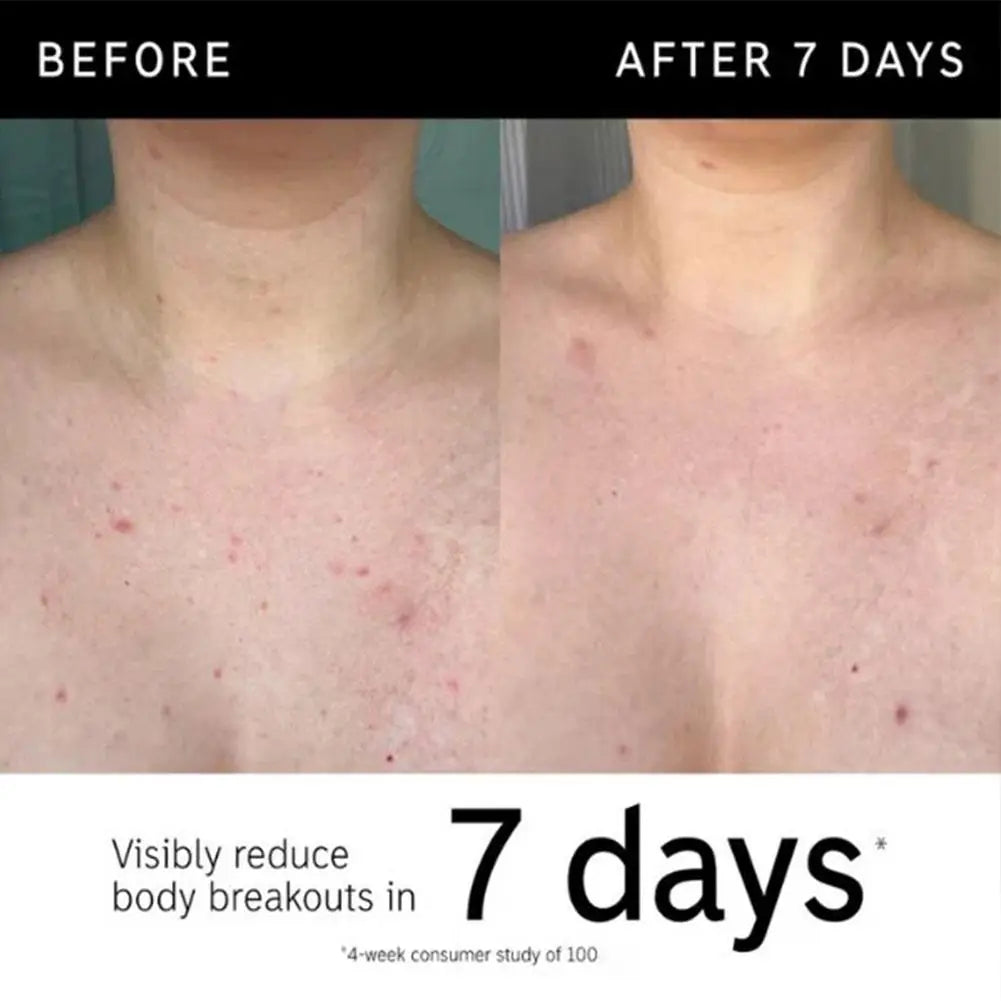    The INKEY List Glycolic Acid Body Stick